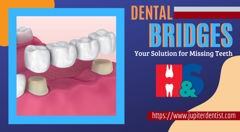 Solution for Teeth Gaps with Dental Bridges